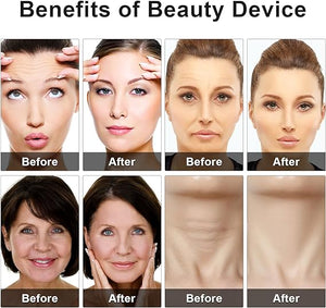 Eye Beauty Device – Portable Eye Massage & Skincare Tool