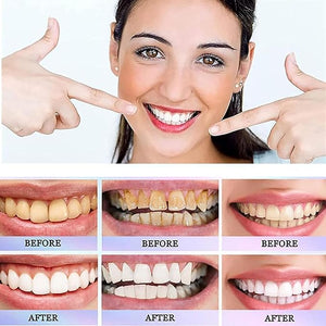 Oralhoe Nicotinamide Dazzle White Toothpaste – Daily Oral Care & Brightening Toothpaste