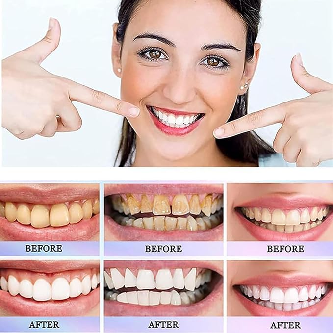 Oralhoe Nicotinamide Dazzle White Toothpaste – Daily Oral Care & Brightening Toothpaste