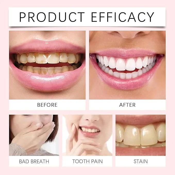 Oralhoe Nicotinamide Dazzle White Toothpaste – Daily Oral Care & Brightening Toothpaste